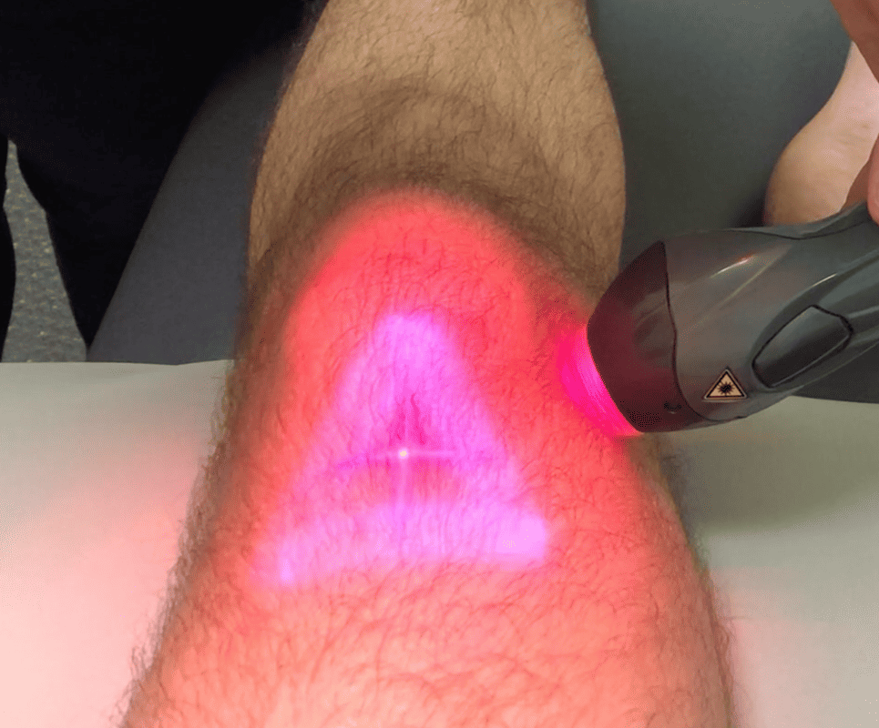 Laser therapy on knee for pain relief and healing.